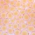 picture of fat tissue
