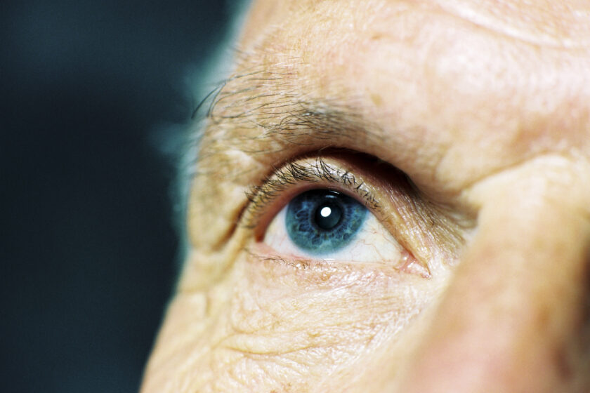 Closeup of an eye