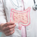 Doctor holding decorative model intestine.