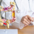 Doctor with human Colon anatomy model and tablet.