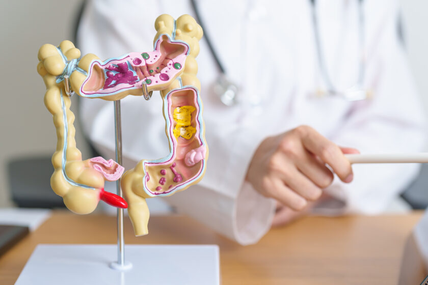 Doctor with human Colon anatomy model and tablet.